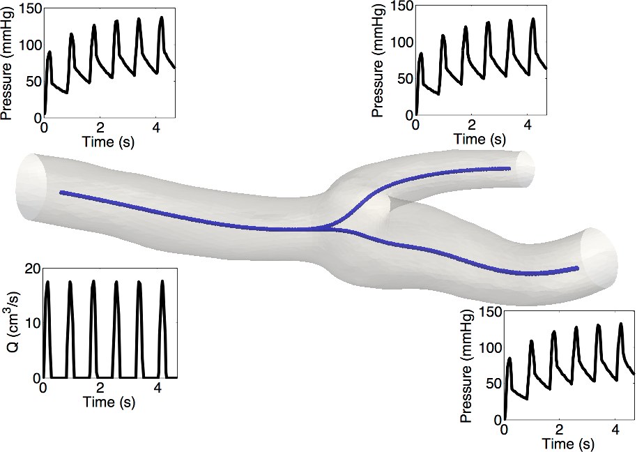 Pulse wave modelling of an arterial bifurcation